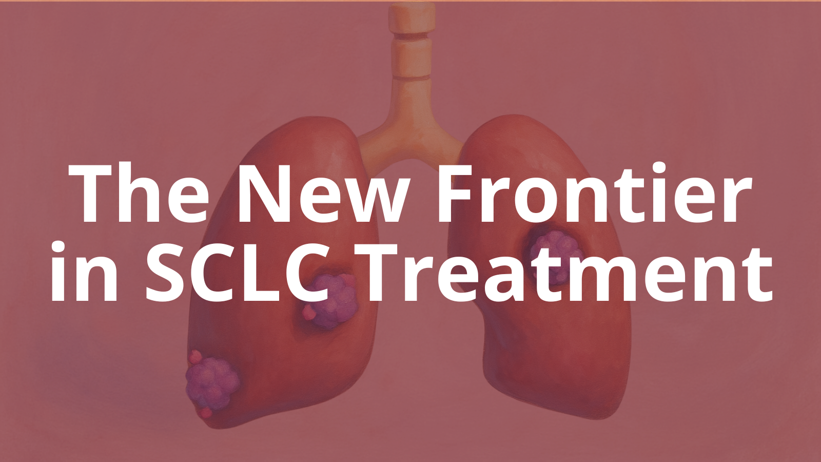 The New Frontier in SCLC Treatment: 4 Antigens Driving Antibody Innovation