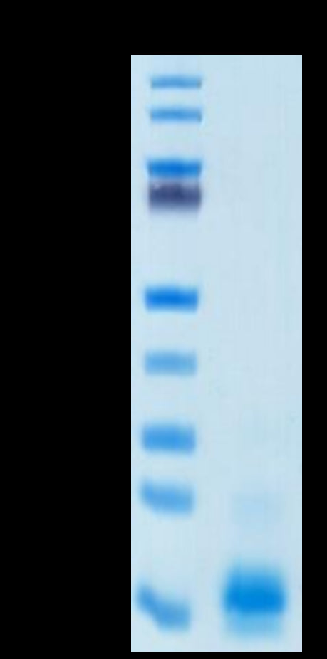 Non-biotinylated Human MCP-1/CCL2 Protein (MCP-HM401)