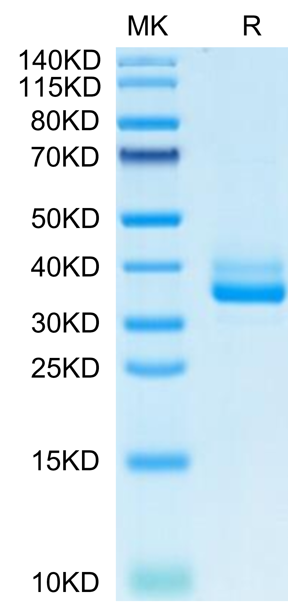 Non-biotinylated Mouse IgE Protein (IGE-MM401)