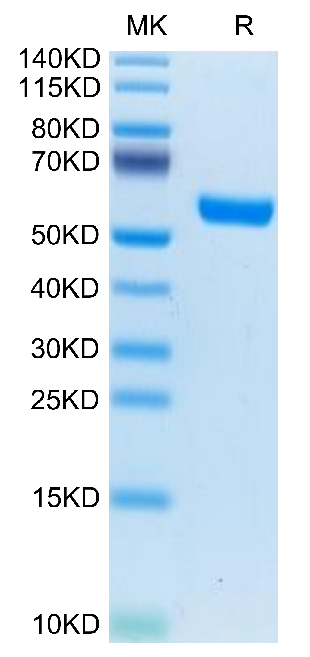 Human IL-19 Protein (IL9-HM219)