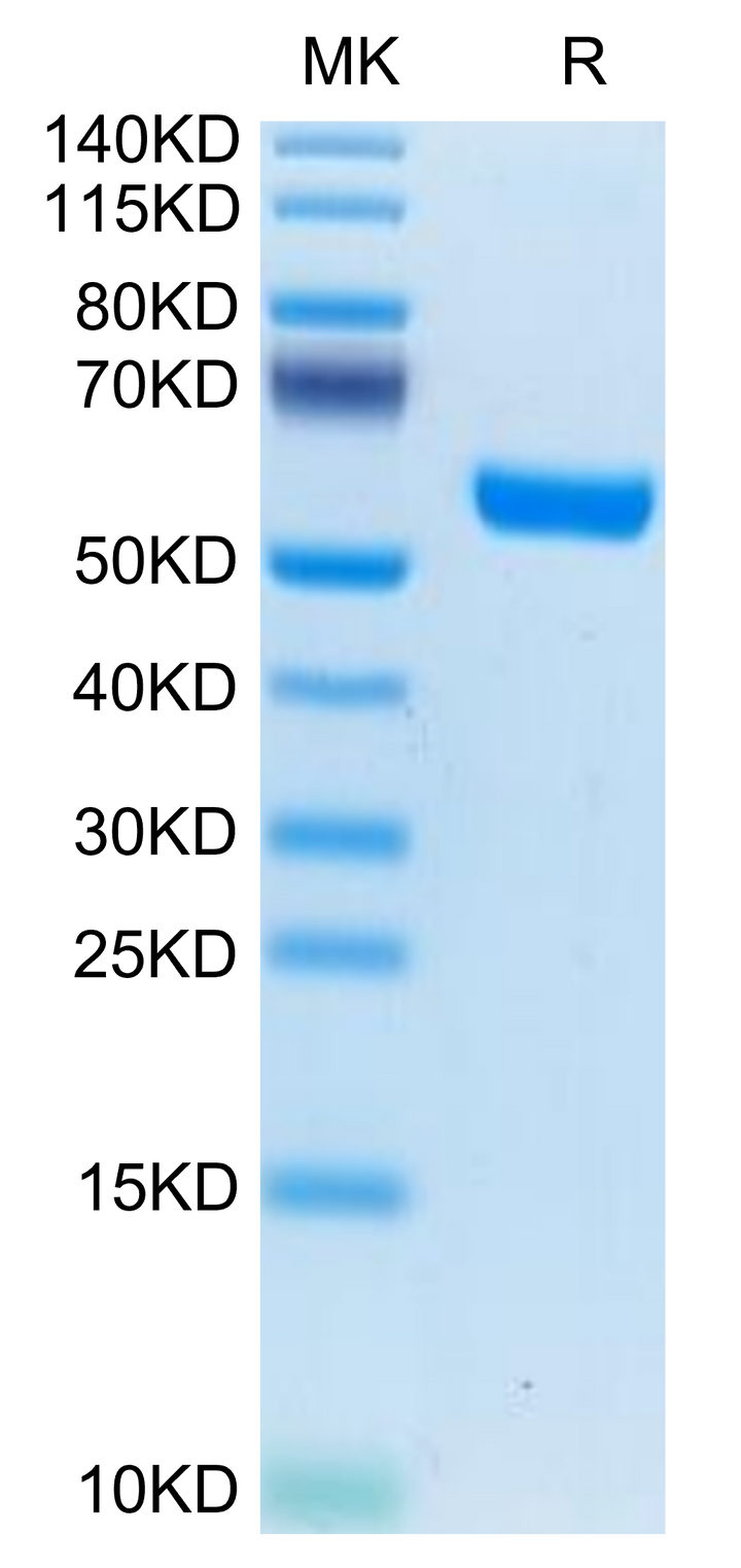 Human IL-19 Protein (IL9-HM219)