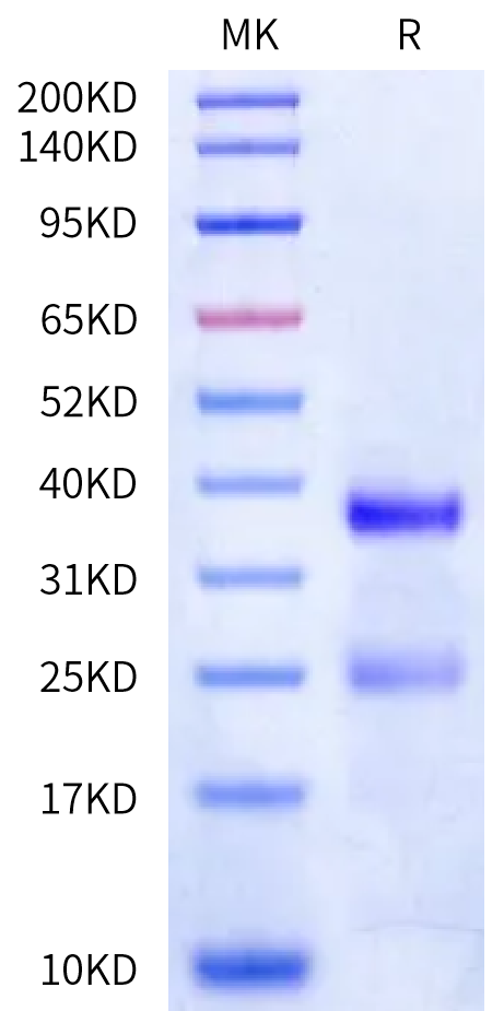 Biotinylated Human PLAU/uPA Protein (active form) (PLA-HM401B)