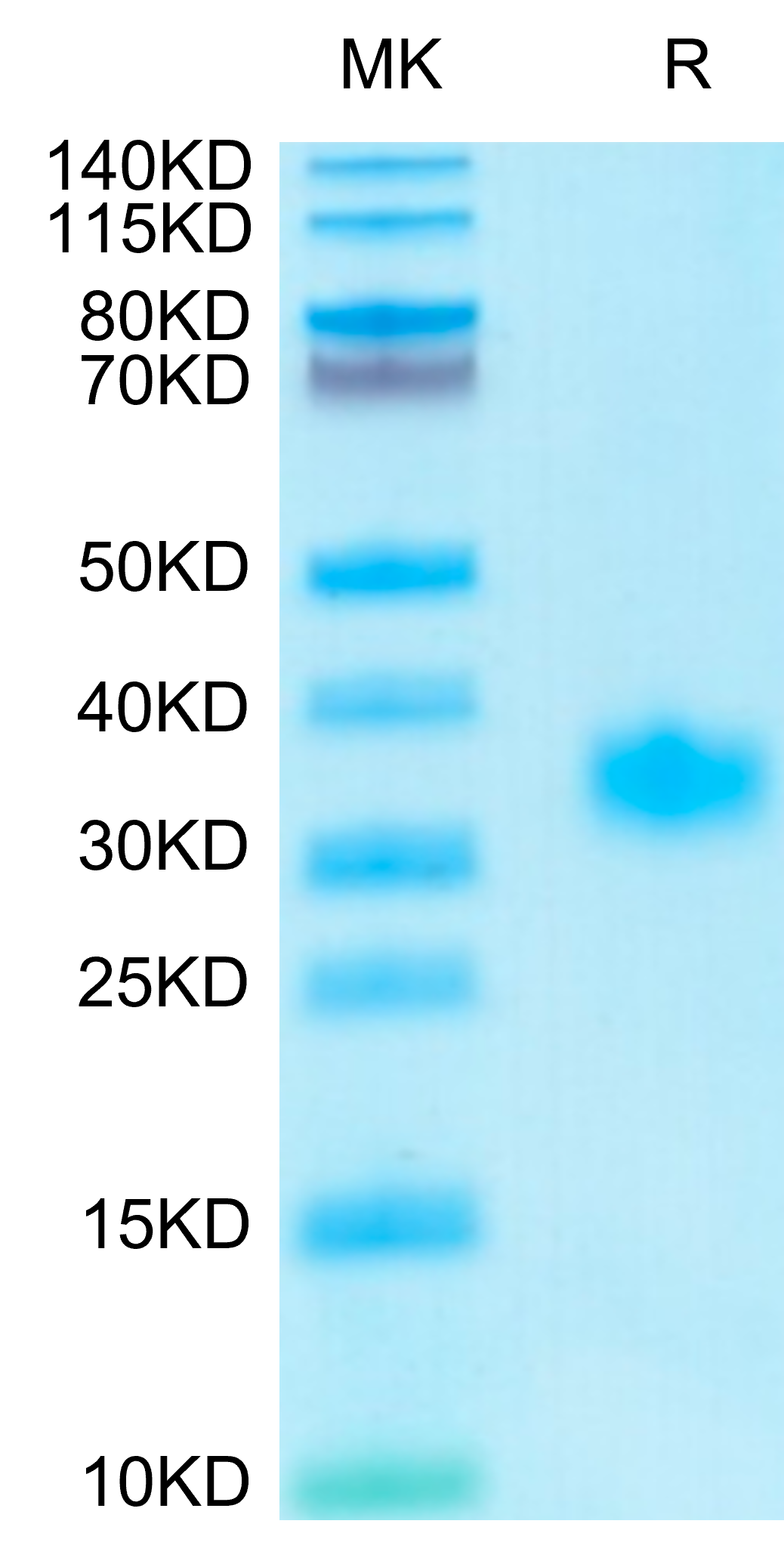 Human Adiponectin/Acrp30 Protein (ADI-HM101)