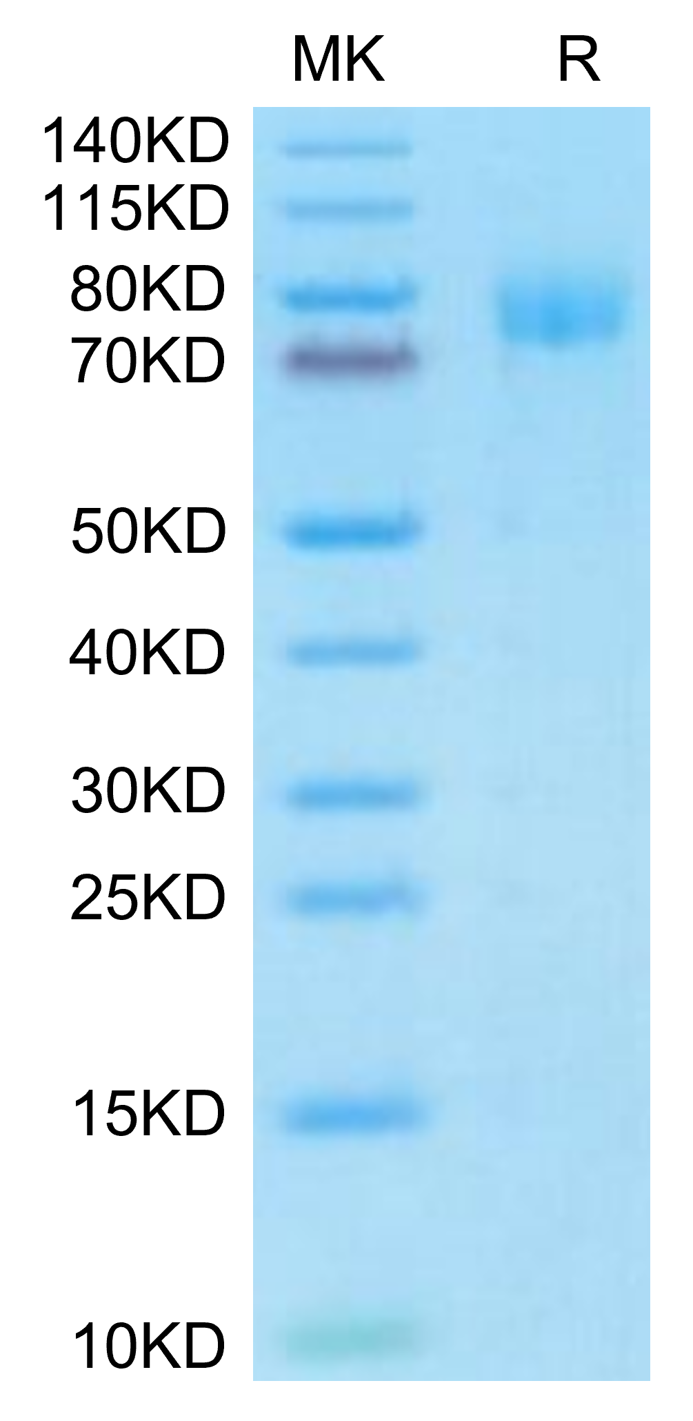 Mouse MUC18/CD146 Protein, Ultra Low Endotoxin (MUC-MM118-UL)