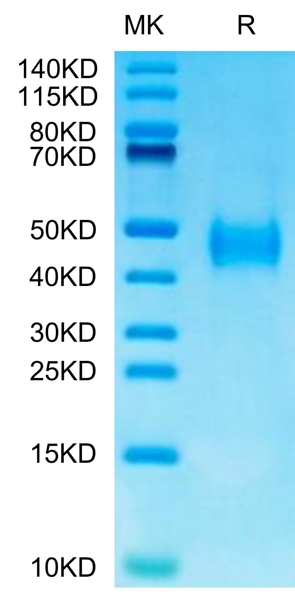 Mouse B7-H3 (2Ig) /CD276 Protein (BH7-MM173)