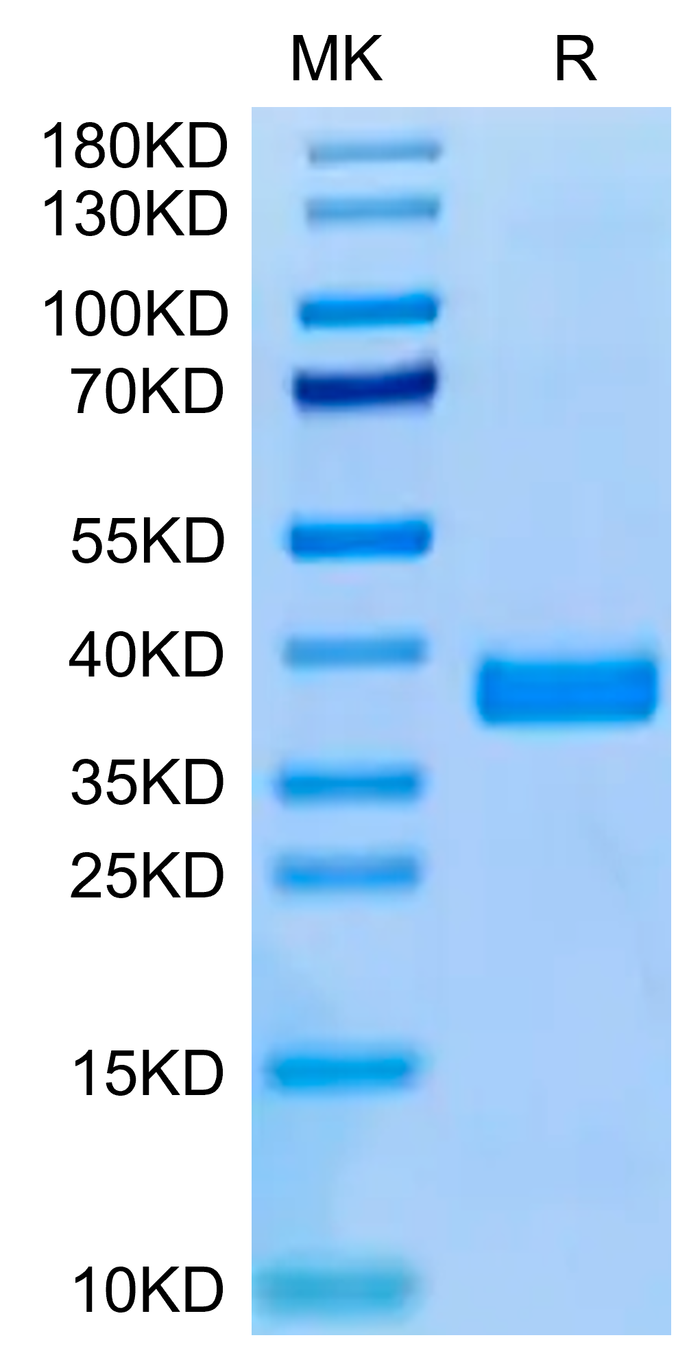 Human APOE3/Apolipoprotein E Protein (APO-HM101)
