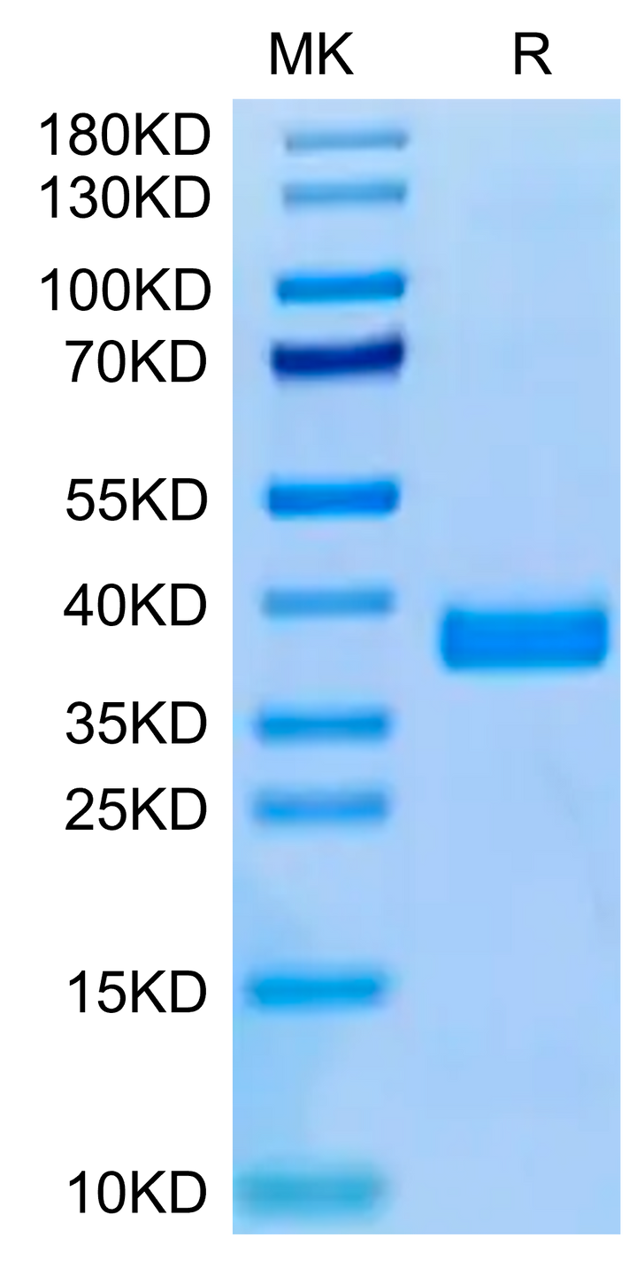 Human APOE3/Apolipoprotein E Protein (APO-HM101)