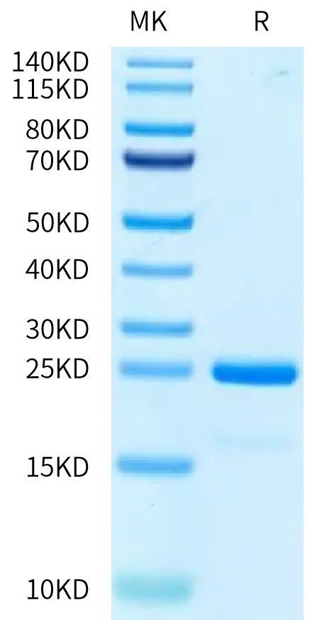 Non-biotinylated Human SKP1 Protein (SKP-HM401)