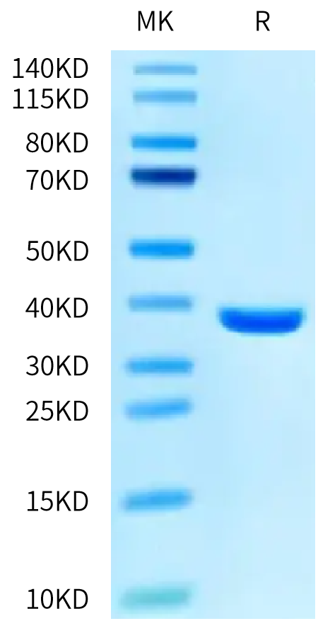 SARS PLpro/papain-like protease Protein (SAR-VE101)