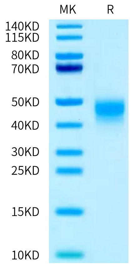 Mouse IL-4 R alpha/CD124 Protein (ILA-MM14R)