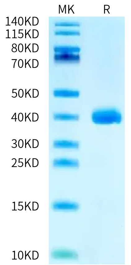 Biotinylated Human APOE3/Apolipoprotein E Protein (APO-HM403B)