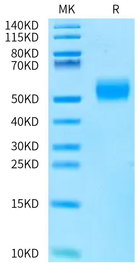 SDS-PAGE gel showing a clear single band in the sample lane, indicating high purity of the protein. Molecular weight marker is visible on the left.
