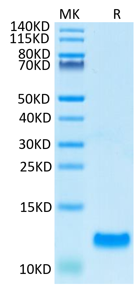 SDS-PAGE image showing protein purity of recombinant protein sample with molecular weight marker on the left and a single band on the right.