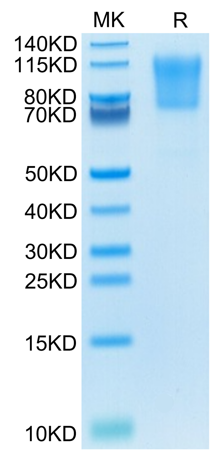 SDS-PAGE gel image showing the molecular weight and purity of the recombinant protein sample compared with a protein ladder.