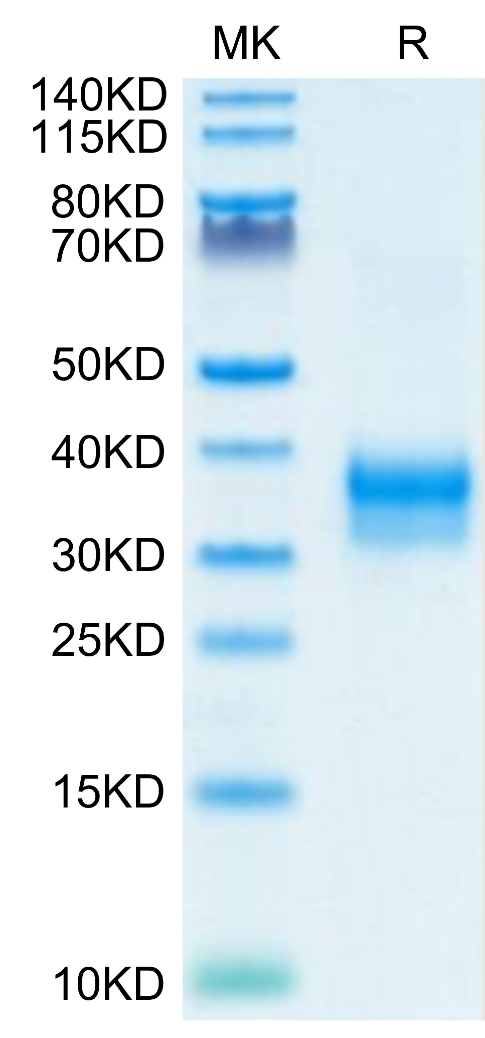 Mouse Siglec-15 Cd33l3 Protein (sig-mm115) – Kactus