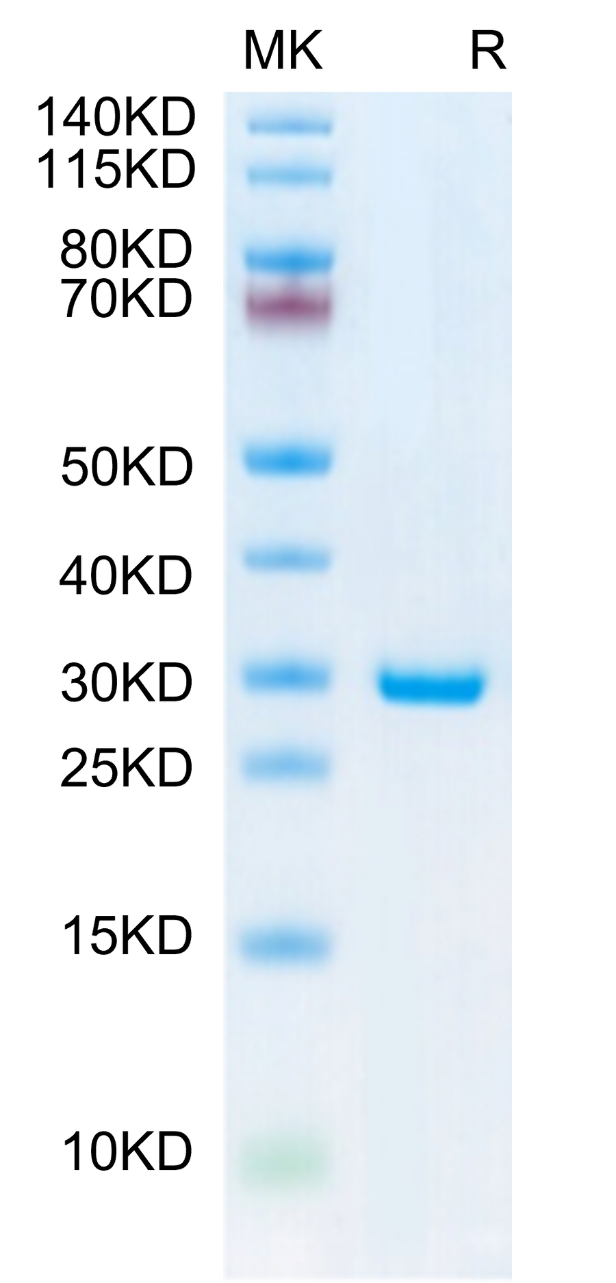 SDS-PAGE image showing purified protein band with molecular weight marker for validation of sample quality and expression level.