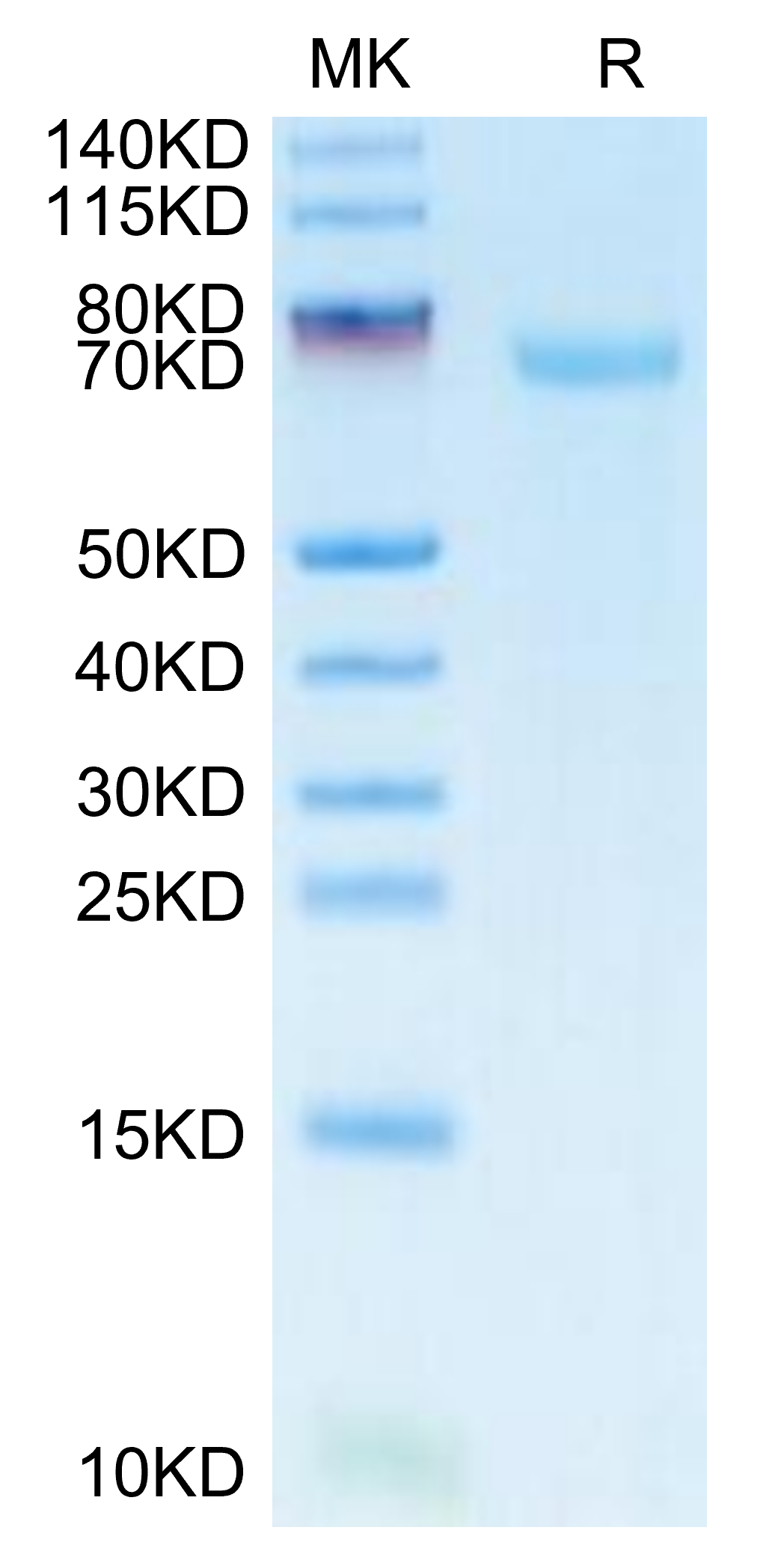 SDS-PAGE image showing protein purity and molecular weight estimation of recombinant protein.