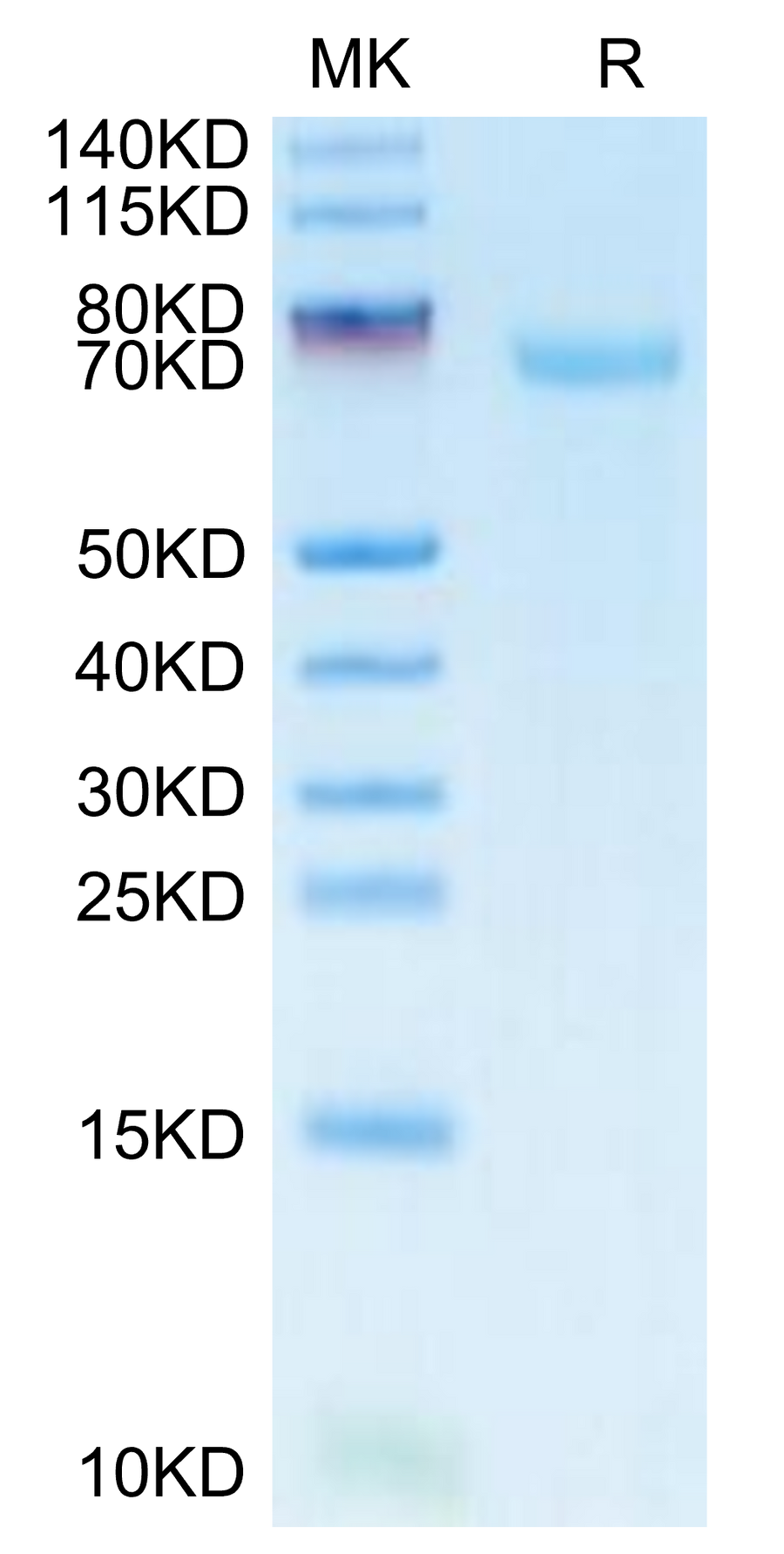 SDS-PAGE image showing protein purity and molecular weight estimation of recombinant protein.