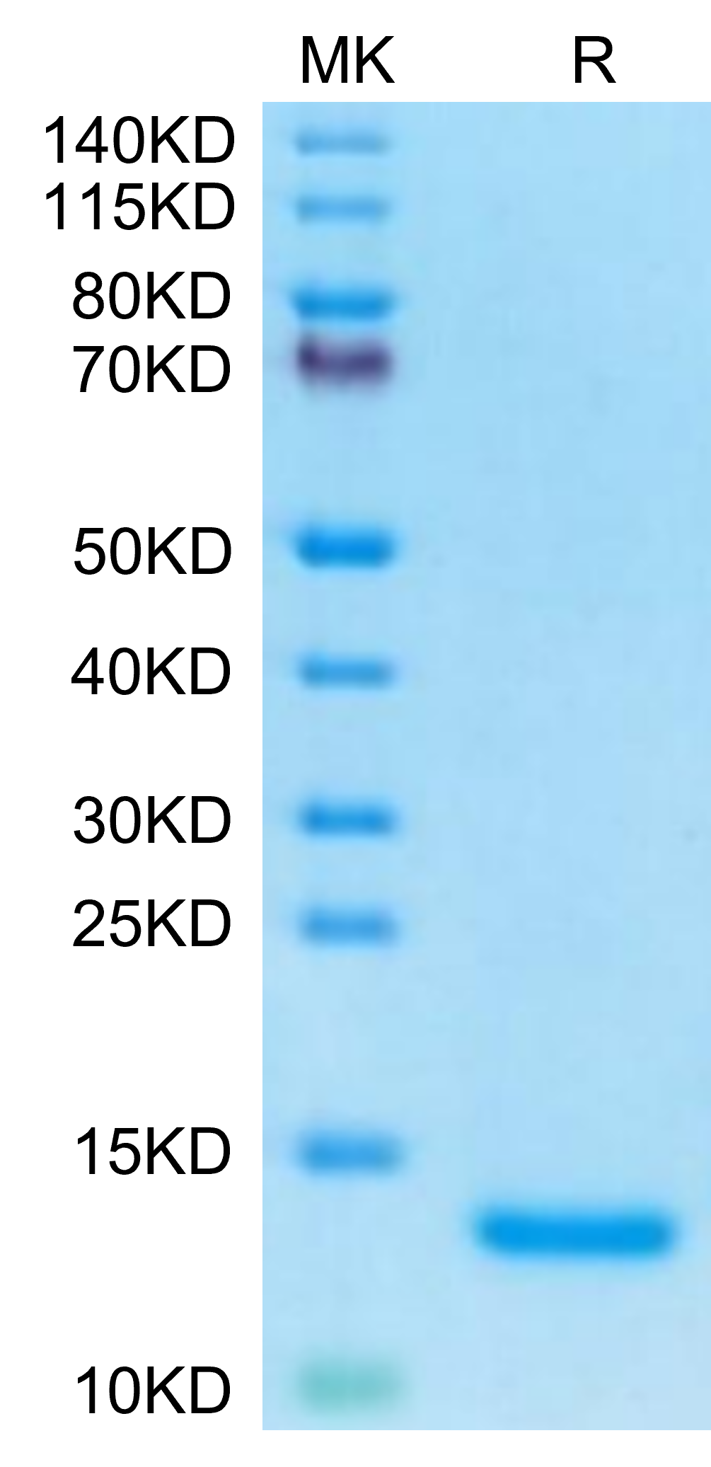 Human Complement C5a Protein (C5A-HE15A)