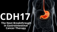 CDH17: The Next Breakthrough in Gastrointestinal Cancer Therapy