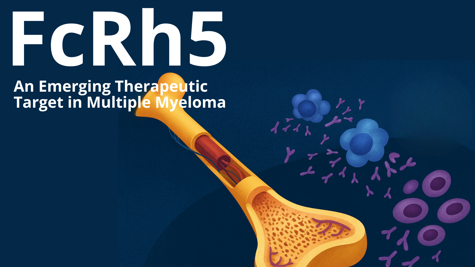 FcRh5: An Emerging Therapeutic Target in Multiple Myeloma