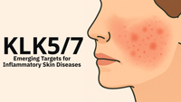 KLK5/7: Emerging Targets for Inflammatory Skin Diseases