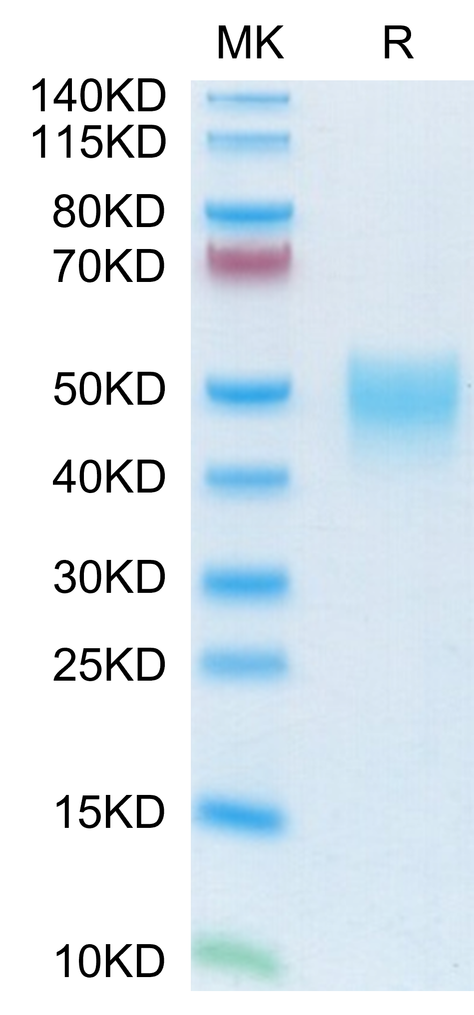 Mouse NKp46/NCR1/CD335 Protein, Ultra Low Endotoxin (NKP-MM146-UL)