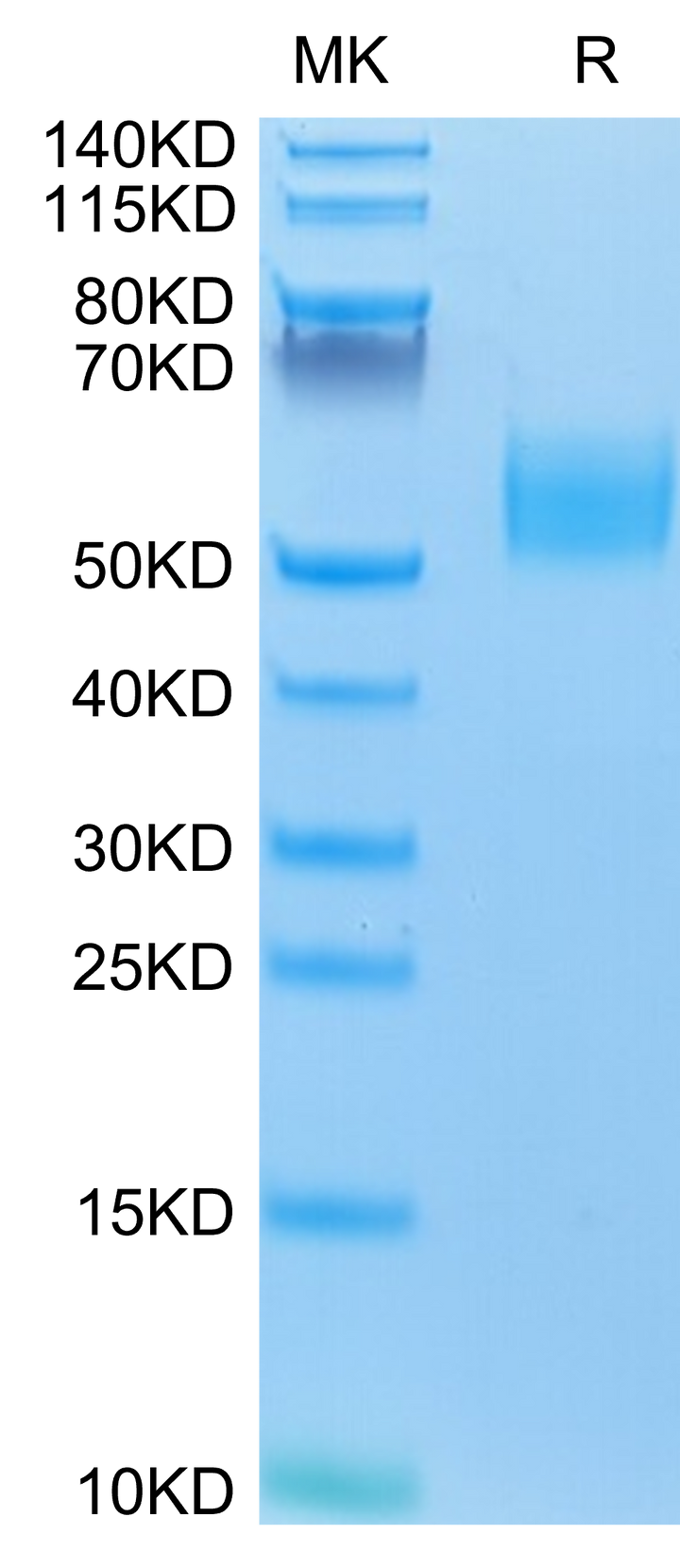 Mouse IL-13Ra1 Protein (ILR-MM1R1)