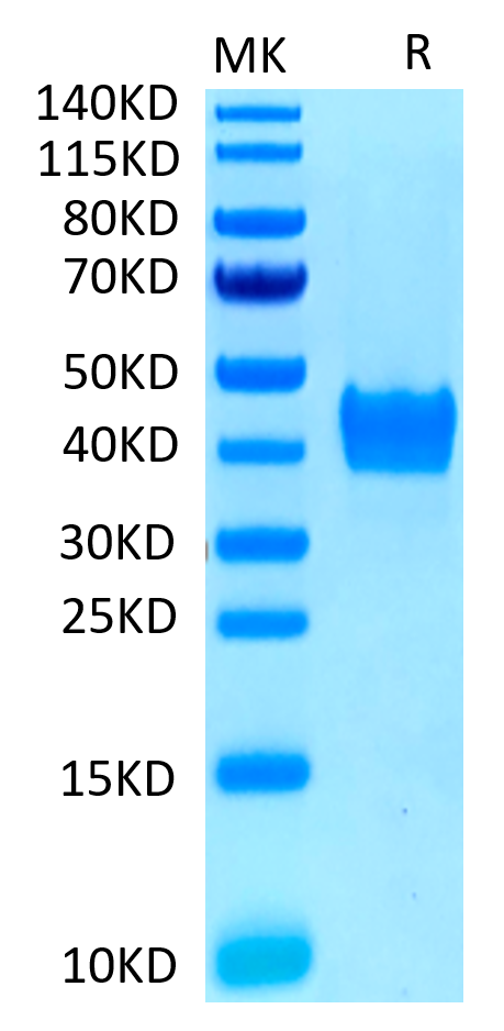 Human CD52 Protein (CD5-HM352)