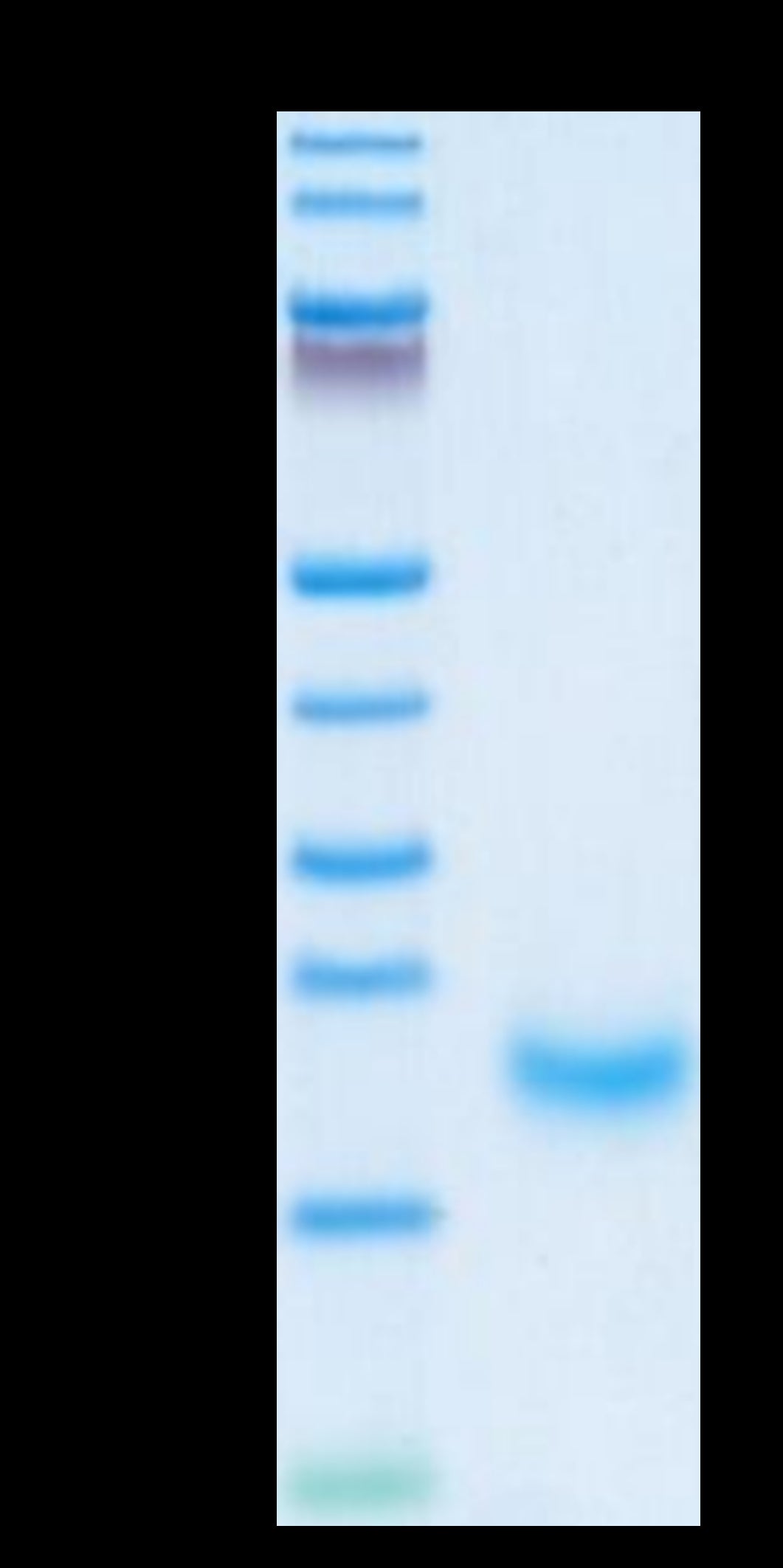 Human/Cynomolgus/Rhesus macaque ROR1 (308-395, Kringle Domain) Protein (ROR-HM10K)