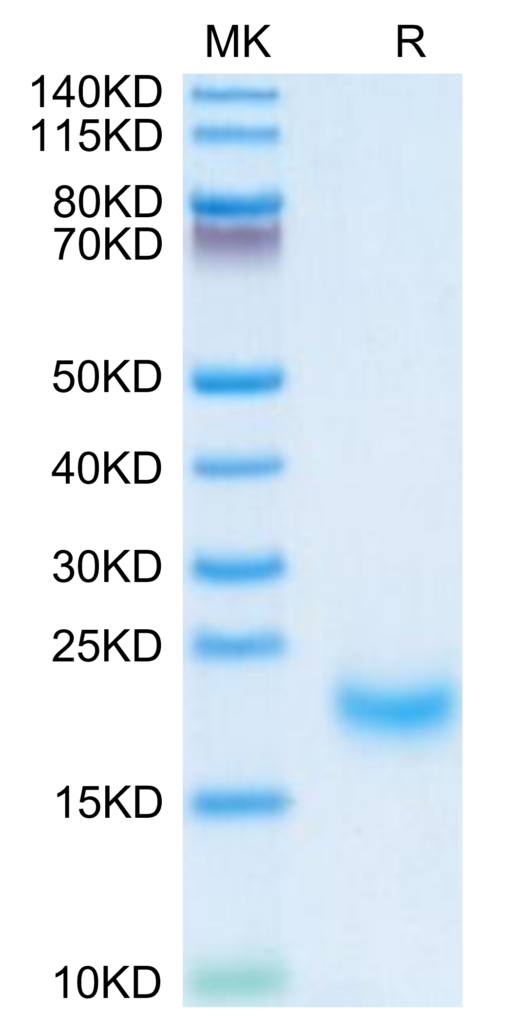Human/Cynomolgus/Rhesus macaque ROR1 (308-395, Kringle Domain) Protein, Ultra Low Endotoxin (ROR-HM10K-UL)