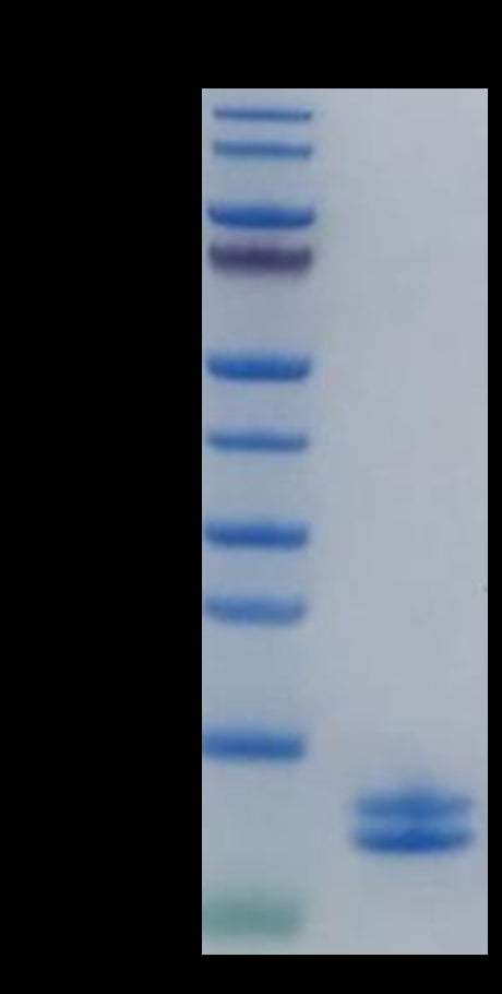 Human Calprotectin (S100A8&S100A9) Protein (CAL-HE101)