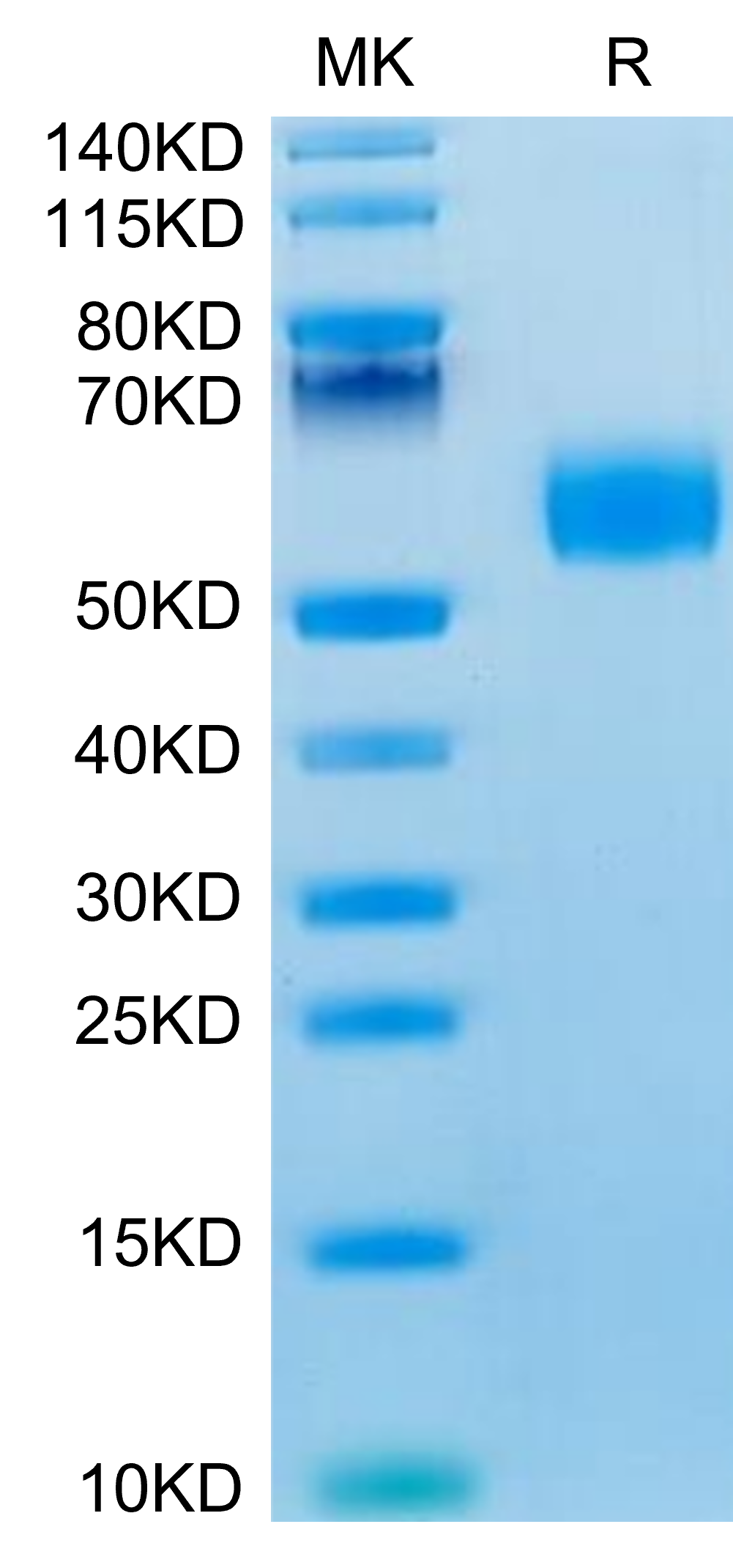 Mouse IL-3 Protein, Ultra Low Endotoxin (IL3-MM201-UL)