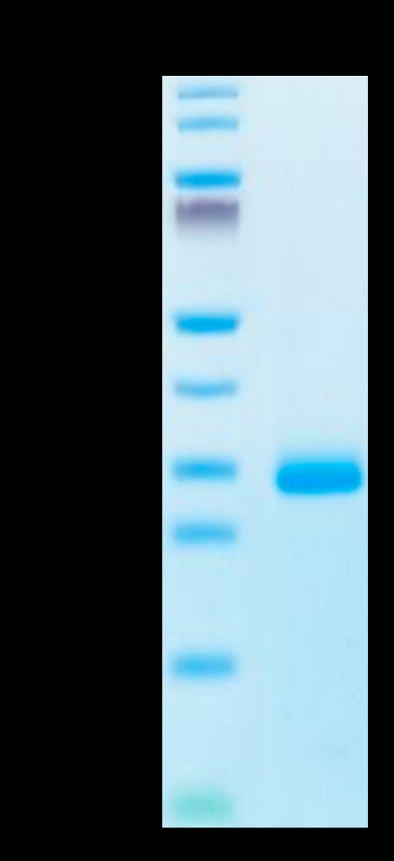 Human Noggin Protein (NOG-HM001)