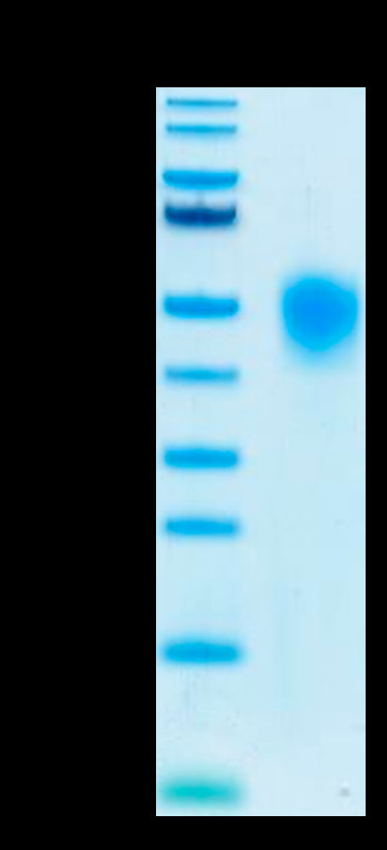 Human KIR2DL1 Protein (KIR-HM4L1)