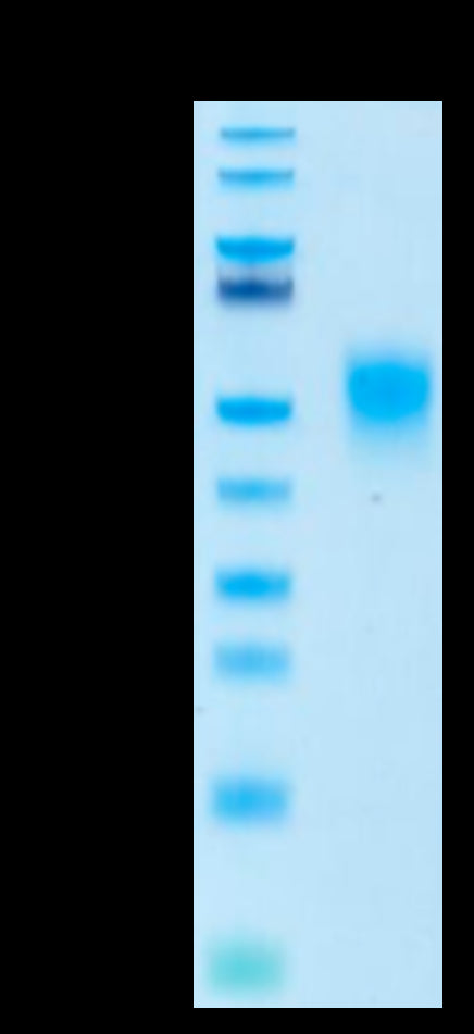 Biotinylated Human KIR2DL1 Protein (KIR-HM4L1B)