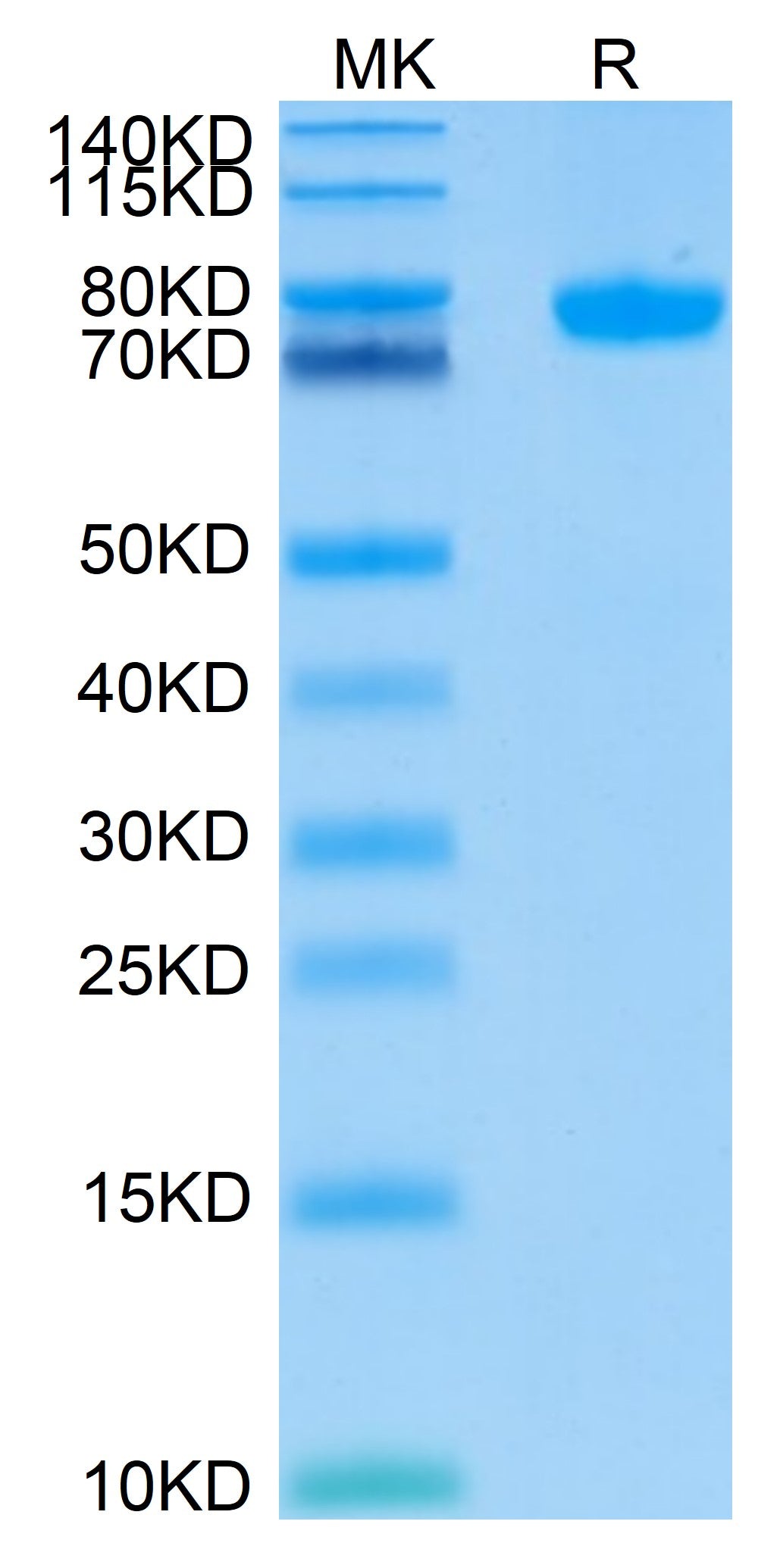 Human Siglec-8 Protein (SIG-HM208)