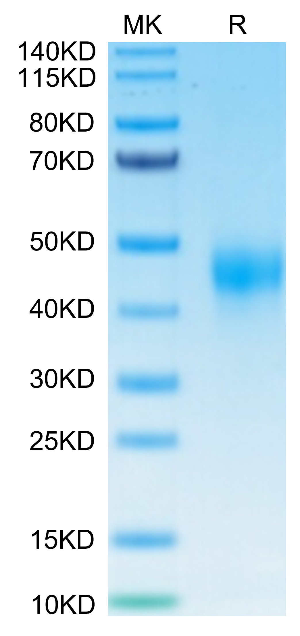 Non-biotinylated Human TFPI Protein, Ultra Low Endotoxin (TFP-HM401-UL)