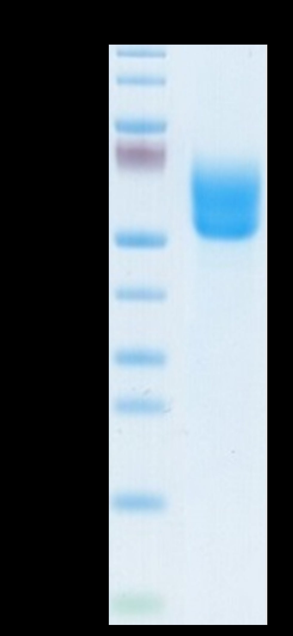 Biotinylated Human DKK3 Protein (DKK-HM403B)