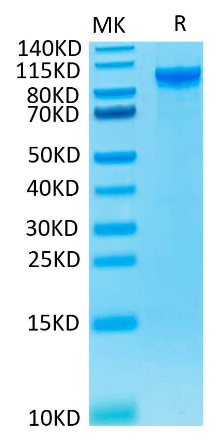 Human ENPP-2/Autotaxin Protein, Ultra Low Endotoxin (ENP-HM101-UL)