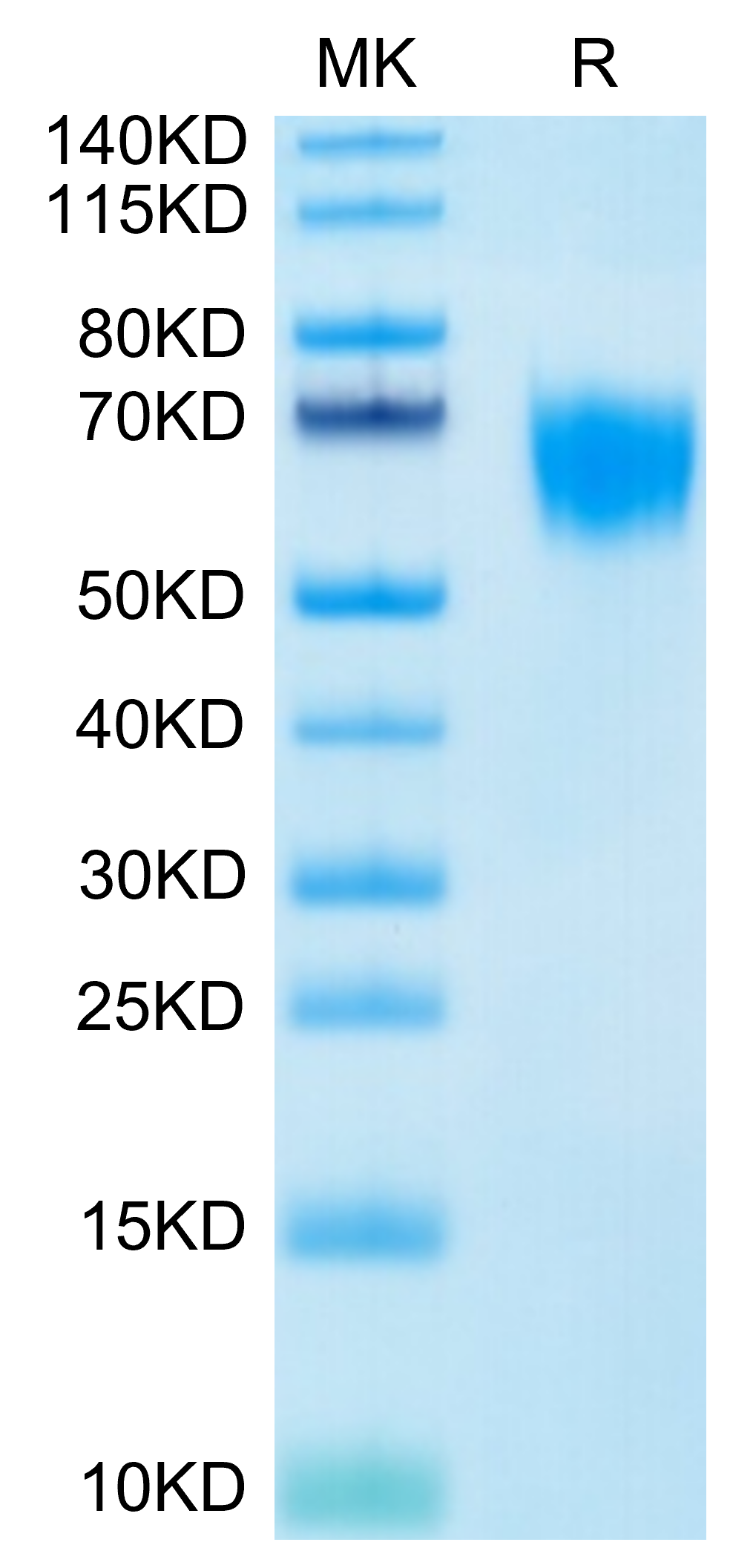 Biotinylated Human FGFR4 Protein, Ultra Low Endotoxin (FGF-HM4R4B-UL)