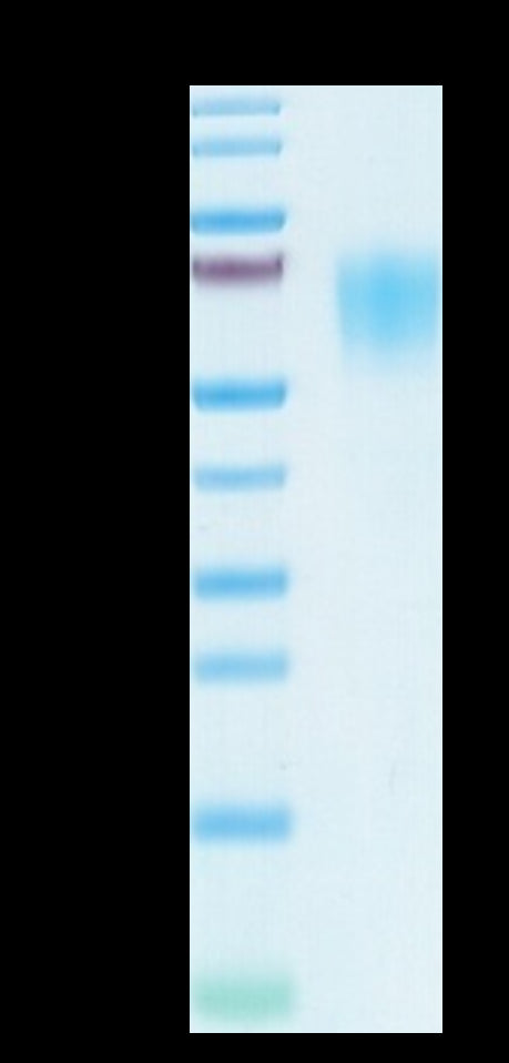 SARS-COV-2 Spike S1 NTD Protein (COV-VM1SN)