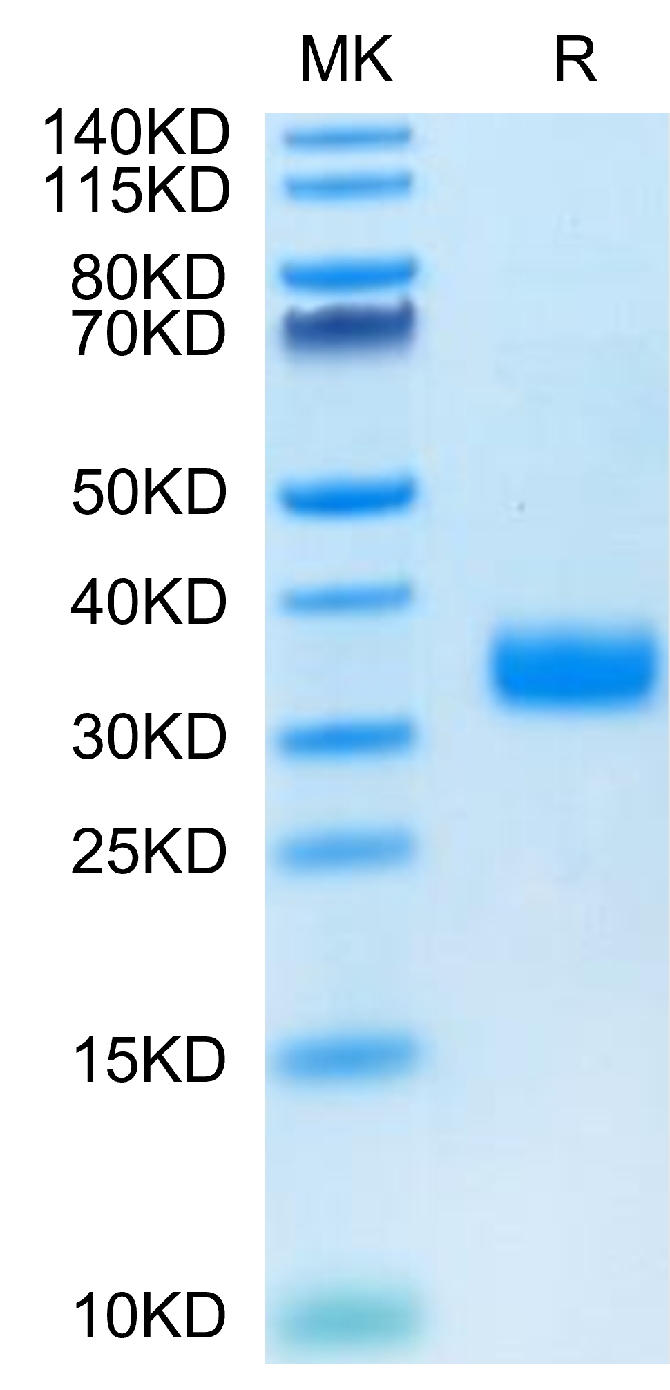 Mouse ANGPTL4/Angiopoietin-like 4 Protein (ANG-MM104)