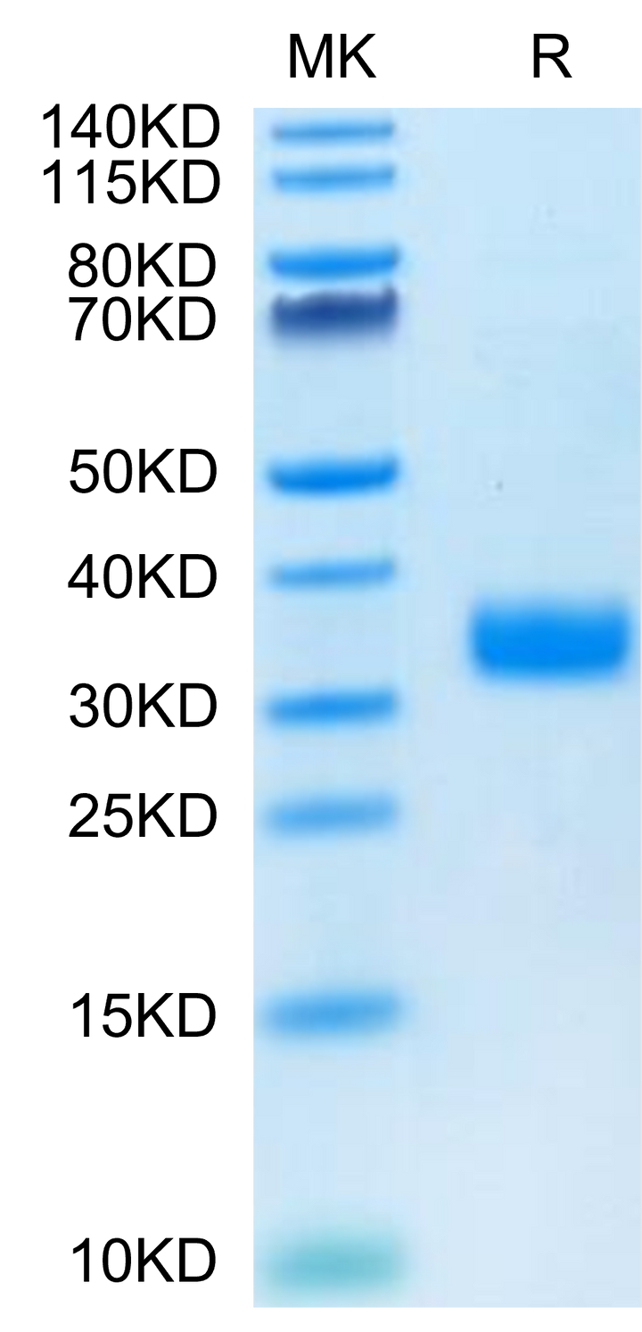 Mouse ANGPTL4/Angiopoietin-like 4 Protein (ANG-MM104)