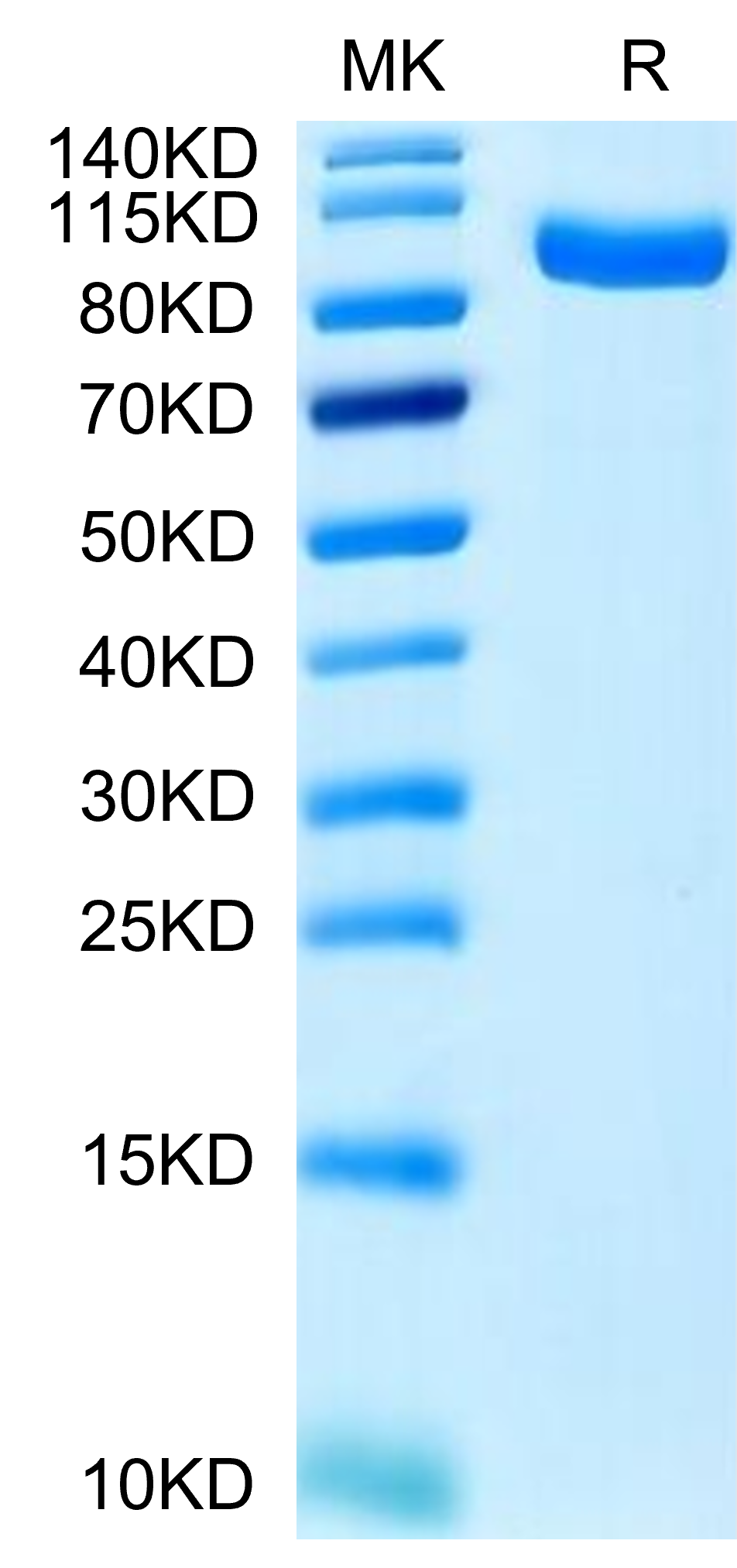 Human PTK7/CCK4 Protein (CCK-HM104)