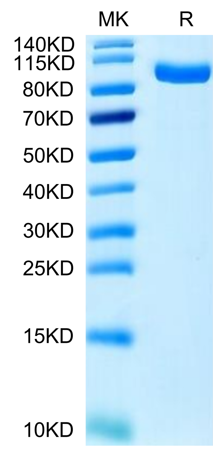 Human PTK7/CCK4 Protein (CCK-HM104)