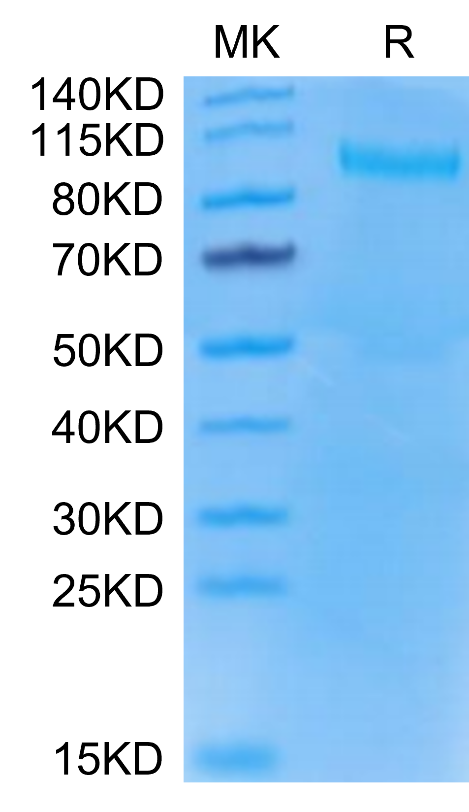 Mouse TLR3 Protein (TLR-MM103)