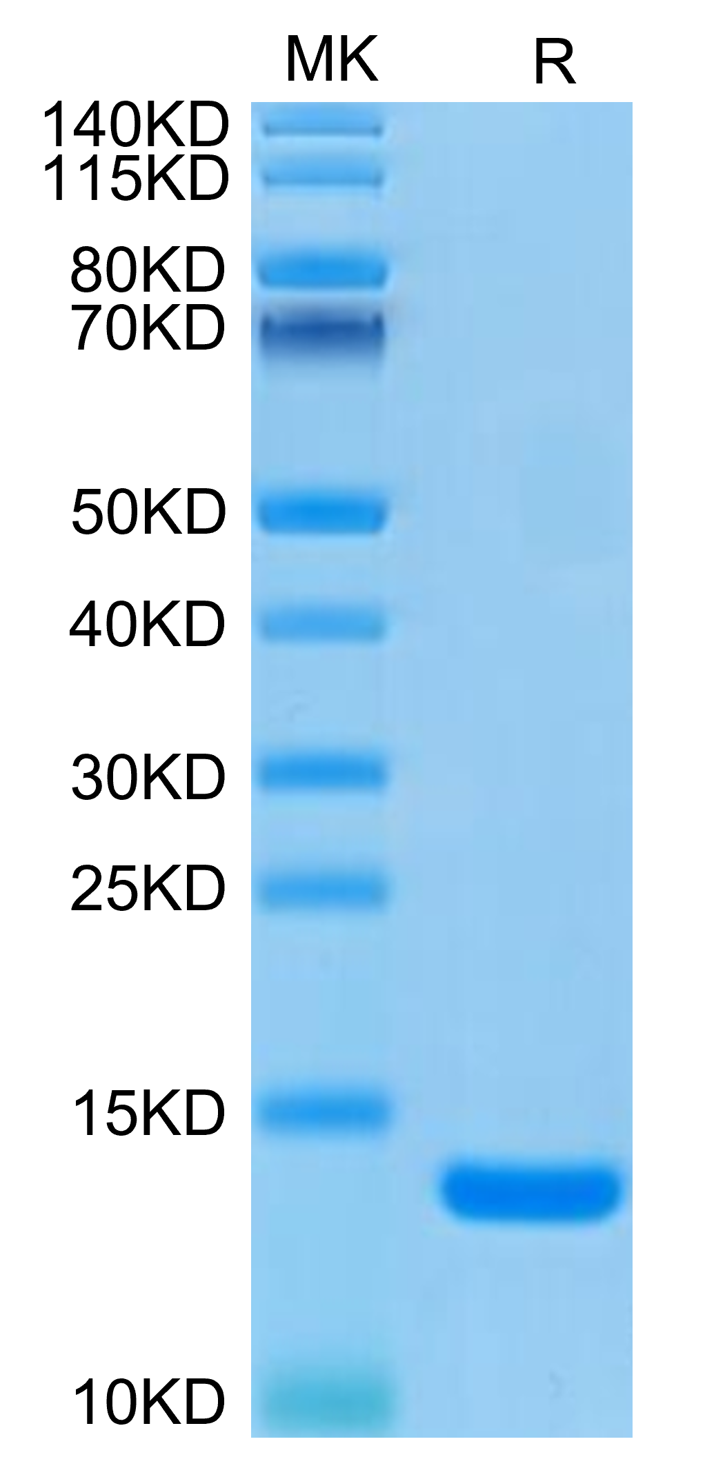 Human B2M/beta 2-Microglobulin Protein (B2M-HM101)