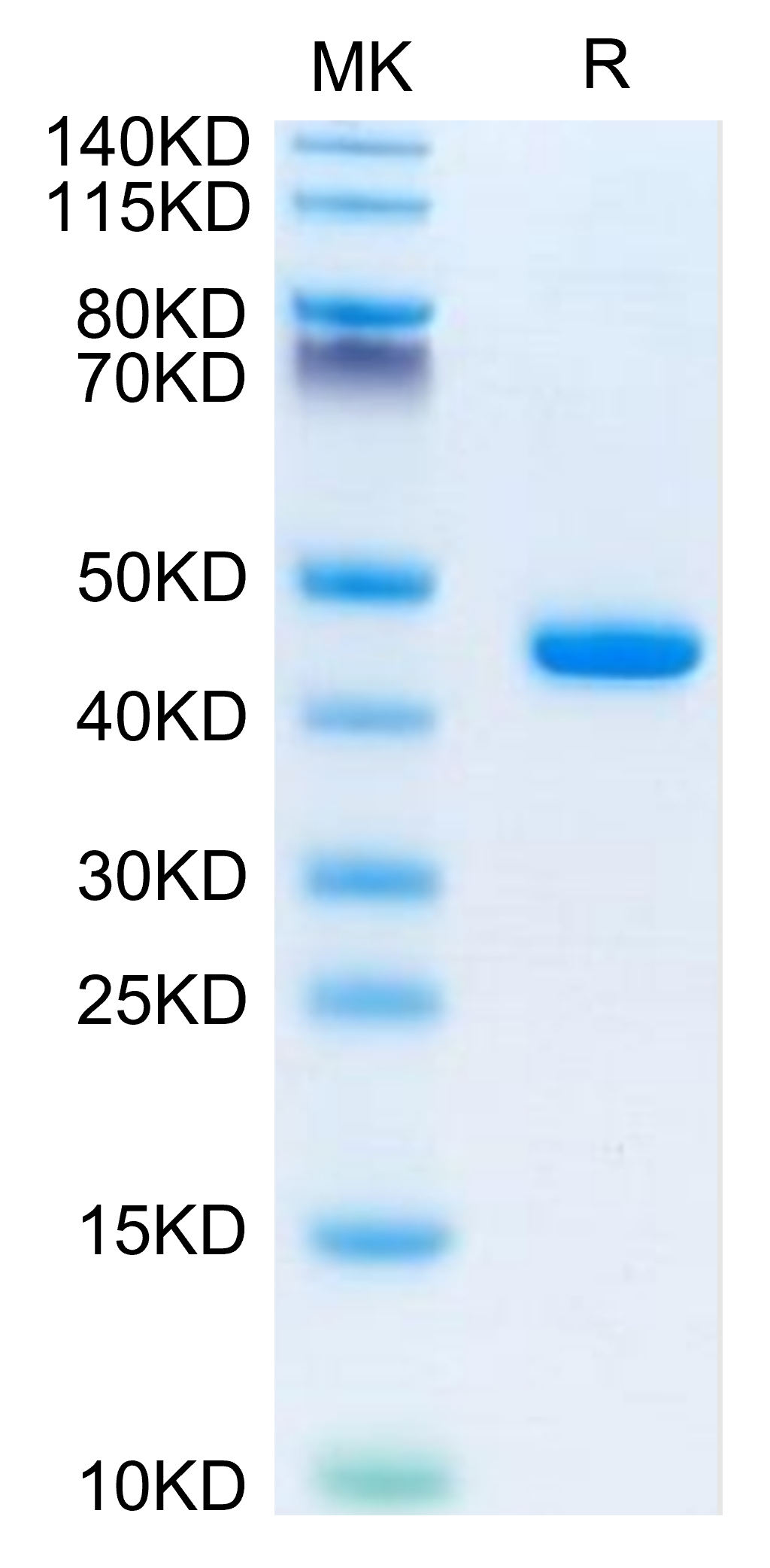 Mouse B2M/beta 2-Microglobulin Protein, Ultra Low Endotoxin (B2M-MM201-UL)