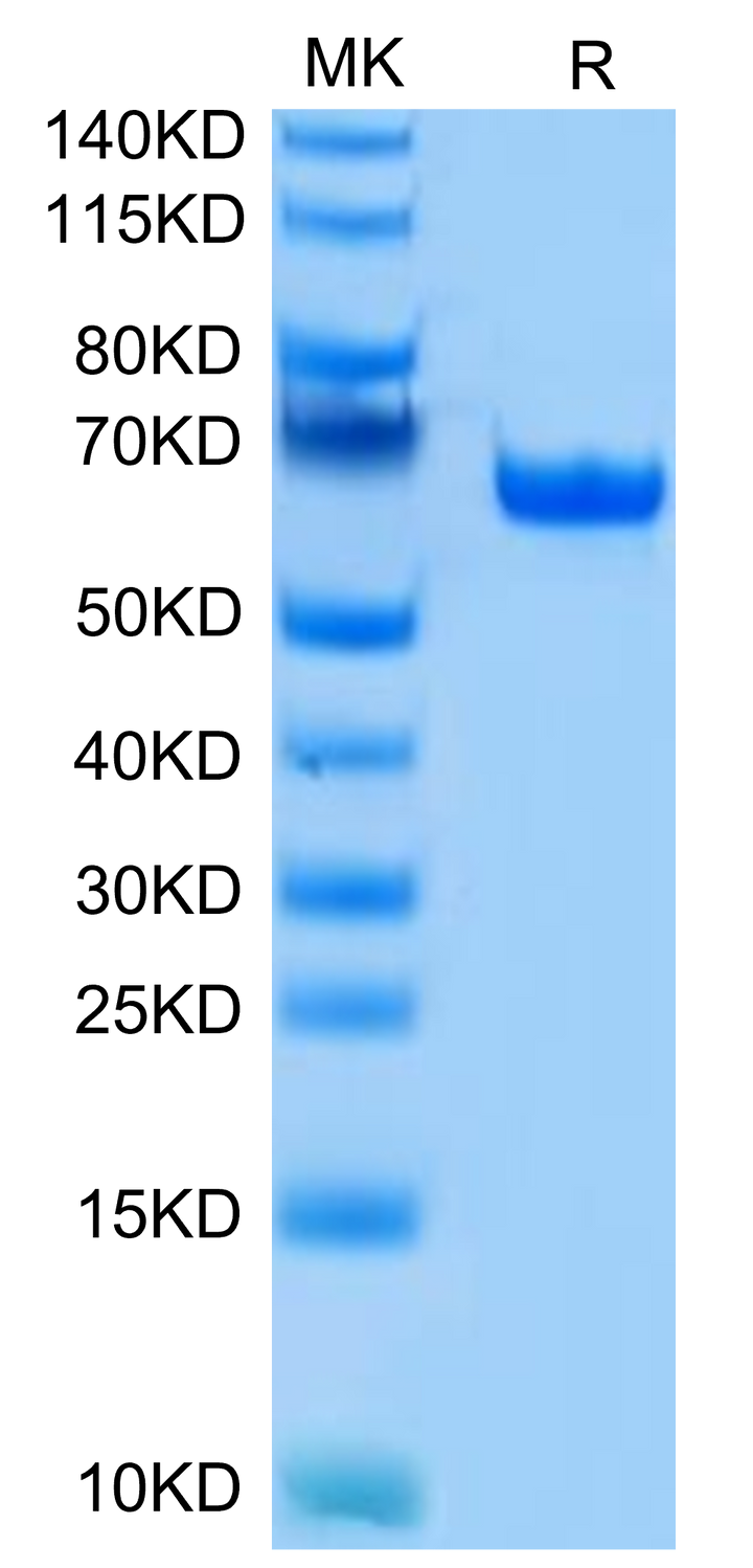 Human BTN1A1/Butyrophilin Protein (BTN-HM2A1)